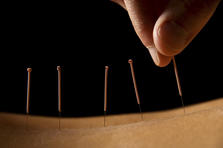 A Comprehensive Guide to the Ancient Practices of Acupuncture
